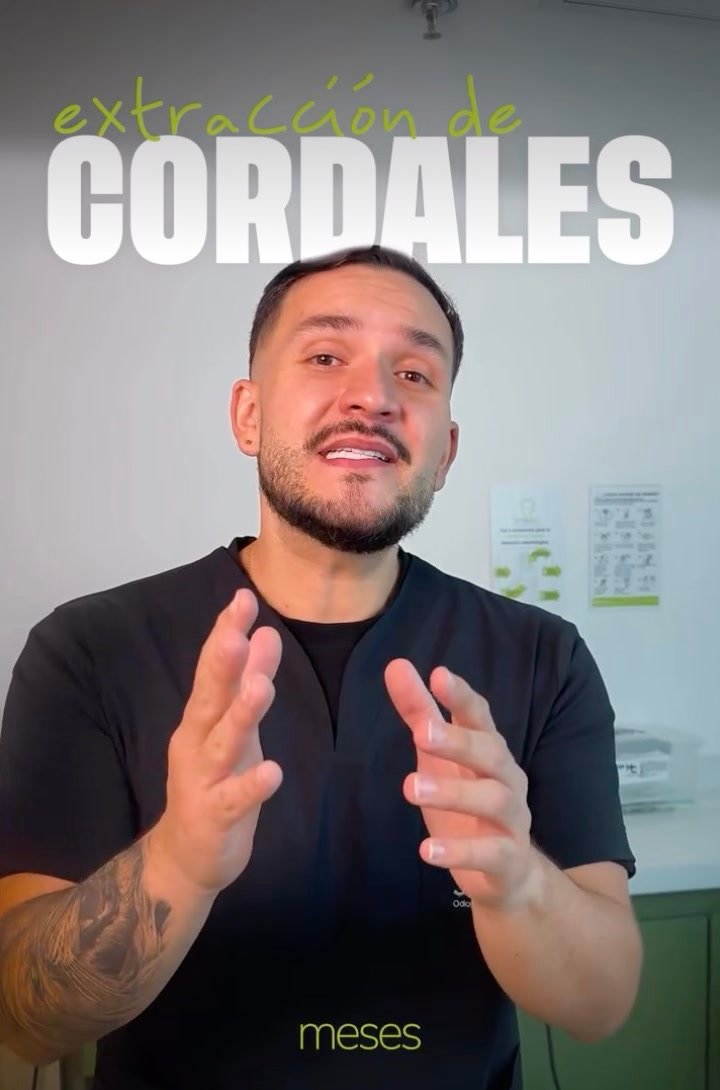 Extracción de cordales · Smile Inc.